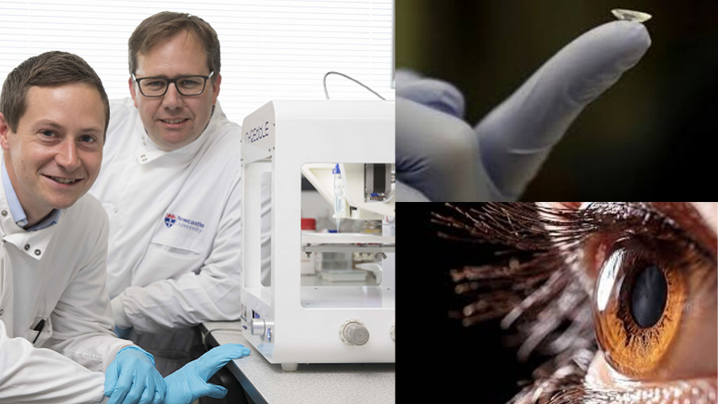 First 3D printed human cornea